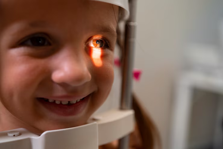 conjuntivitis niños