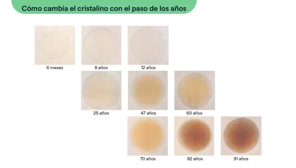 Evolución del cristalino