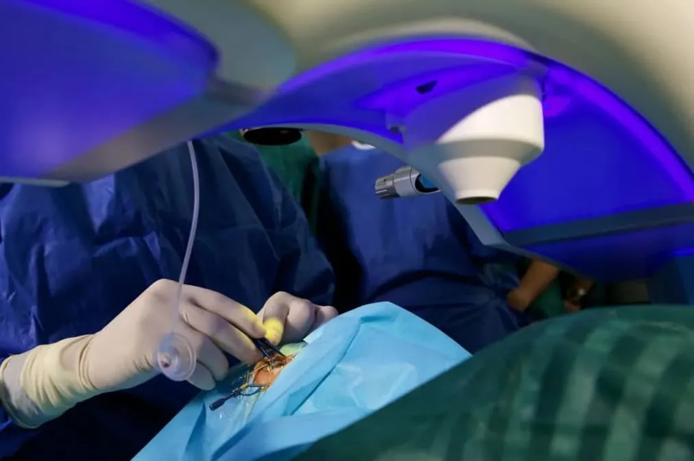 cirugía refractiva SMILE